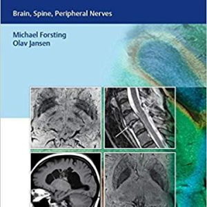 MR Neuroimaging: Brain, Spine, Peripheral Nerves 1st Edition