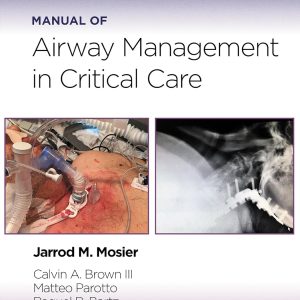 Manual of Airway Management in Critical Care First Edition