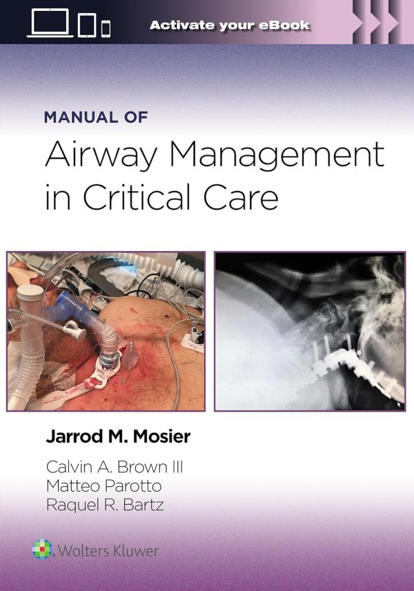 Manual of Airway Management in Critical Care First Edition