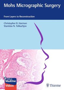 Mohs Micrographic Surgery: From Layers to Reconstruction 1st Edition