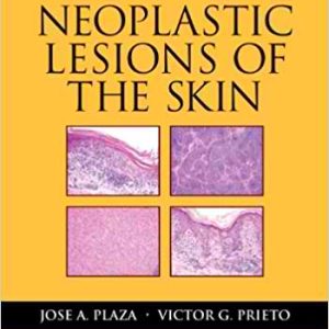 Neoplastic Lesions of the Skin (Demos Surgical Pathology Guides) 1st Edition