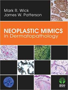 Neoplastic Mimics in Dermatopathology 1st Edition