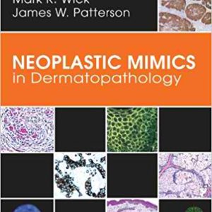 Neoplastic Mimics in Dermatopathology 1st Edition