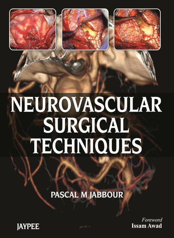 Neurovascular Surgical Techniques First Edition