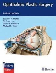 Ophthalmic Plastic Surgery Tricks of the Trade First Edition