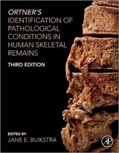 Ortner's Identification of Pathological Conditions in Human Skeletal Remains 3rd Edition