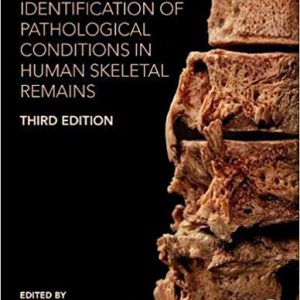 Ortner’s Identification of Pathological Conditions in Human Skeletal Remains 3rd Edition