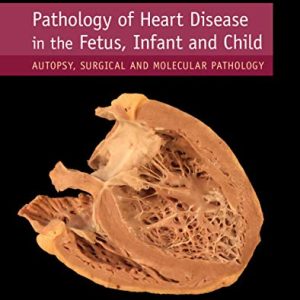 Pathology of Heart Disease in the Fetus, Infant and Child: Autopsy, Surgical and Molecular Pathology 1st Edition