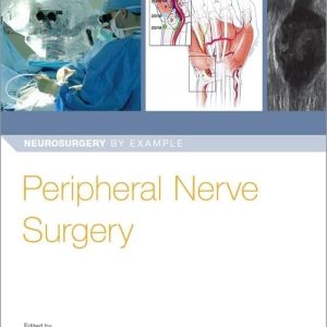 Peripheral Nerve Surgery (Neurosurgery by Example) 1st Edition