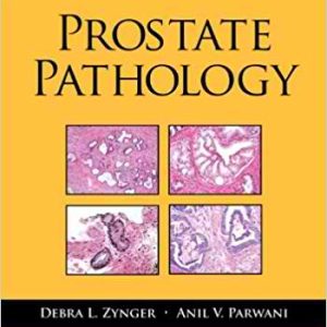 Prostate Pathology (Demos Surgical Pathology Guides) 1st Edition