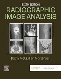 Radiographic Image Analysis Sixth Edition