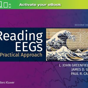 Reading EEGs: A Practical Approach Second Edition