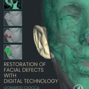 Restoration of Facial Defects with Digital Technology 1st Edition