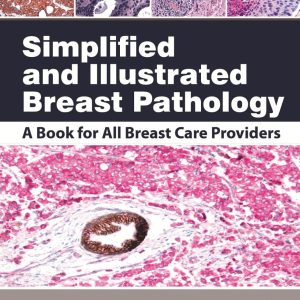 Simplified and Illustrated Breast Pathology First  Edition