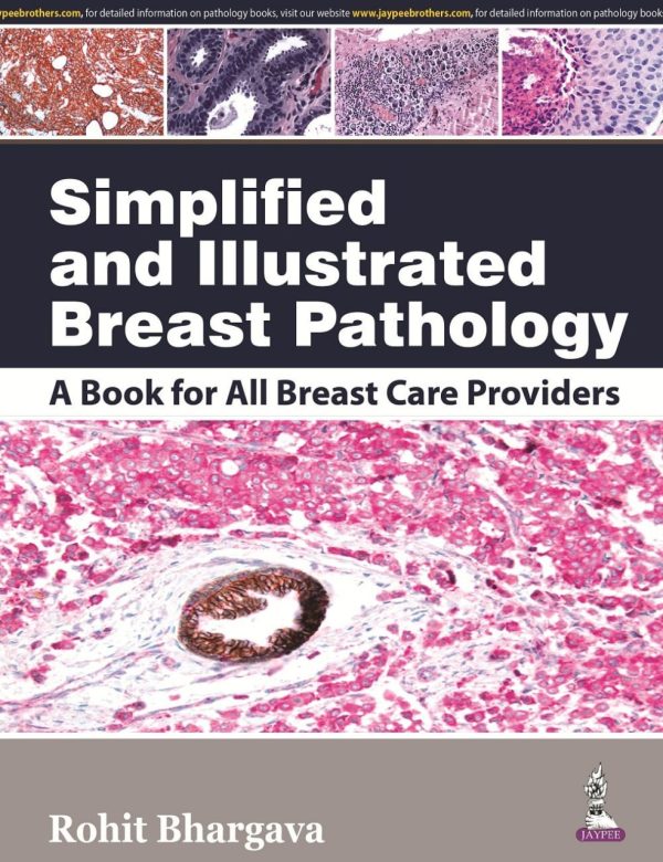 Simplified and Illustrated Breast Pathology First  Edition