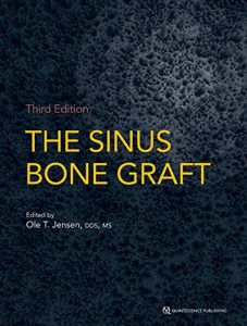 The Sinus Bone Graft Third Edition