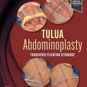 TULUA Abdominoplasty Transverse Plication Technique First Edition