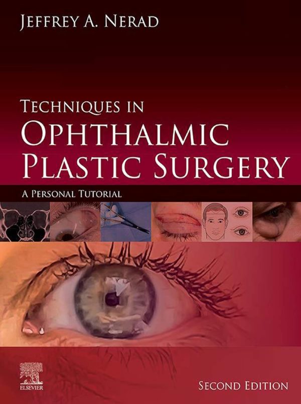 Techniques in Ophthalmic Plastic Surgery: A Personal Tutorial 2nd Edition