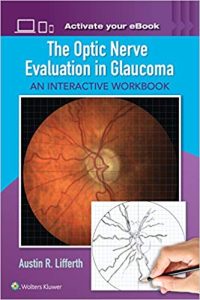 The Optic Nerve Evaluation in Glaucoma:(May 18, 2017)