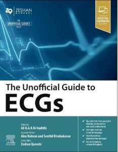 The Unofficial Guide to ECGs First Edition
