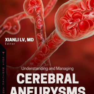 Understanding and Managing Cerebral Aneurysms