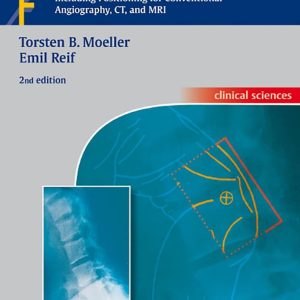 Pocket Atlas of Radiographic Anatomy Including Positioning For Conventional Angiography CT And MRI