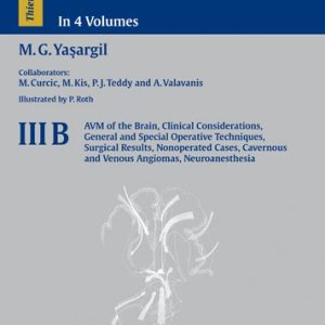 Microneurosurgery  Volume 3 B AVM of the Brain Clinical Considerations  General And Special Operative Techniques  Surgical Results  Nonoperated Cases Cavernous And Venous Angiomas Neuroanesthesia  First Edition