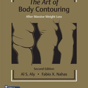 The Art of Body Contouring  After Massive Weight Loss Second Edition