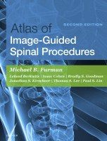 Atlas of Image-Guided Spinal Procedures Second Edition