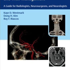 Incidental Findings in Neuroimaging and Their Management  A Guide for Radiologists  Neurosurgeons  and Neurologists First Edition