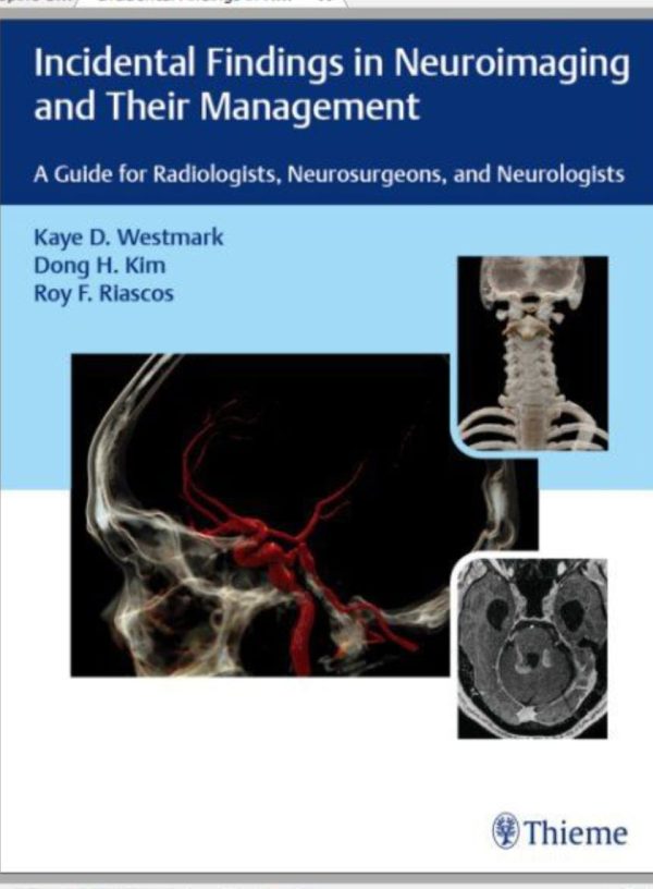 Incidental Findings in Neuroimaging and Their Management  A Guide for Radiologists  Neurosurgeons  and Neurologists First Edition