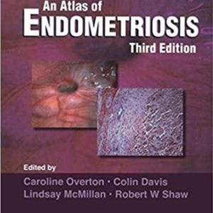 An Atlas of Endometriosis Third Edition