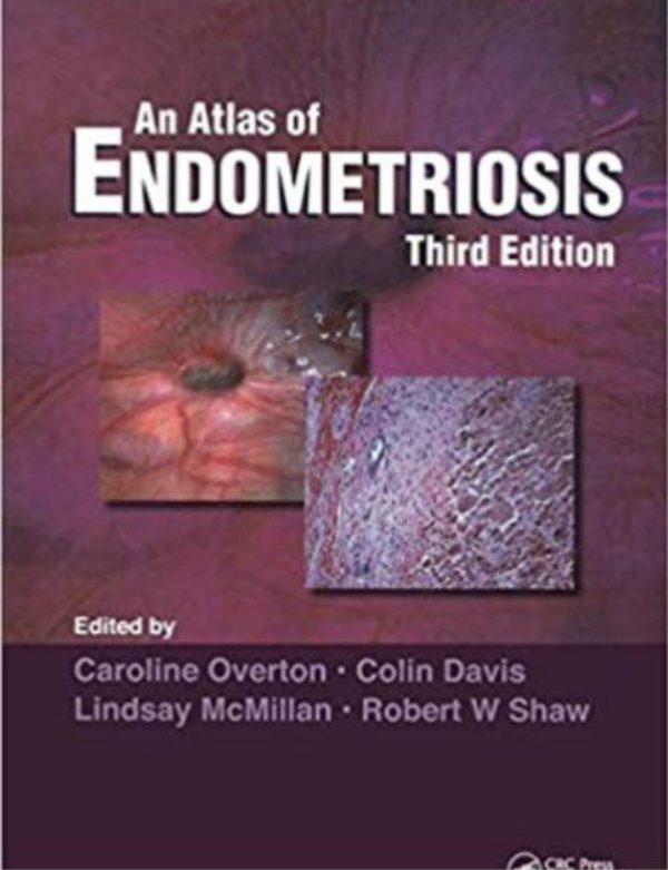 An Atlas of Endometriosis Third Edition