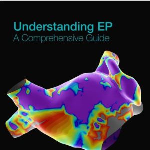 Understanding EP: A Comprehensive Guide First Edition