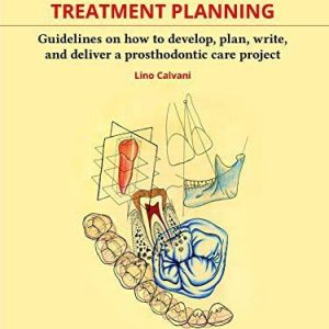 Fundamentals of Treatment Planning: Guidelines on How to Develop  Plan, Write  and Deliver a Prosthodontic Care Project First Edition