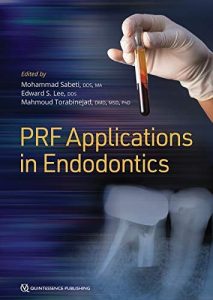 PRF Applications in Endodontics First Edition