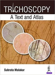Trichoscopy A Text and Atlas First Edition