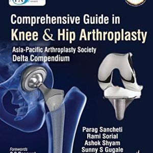 Comprehensive Guide in Knee & Hip Arthroplasty Third Edition