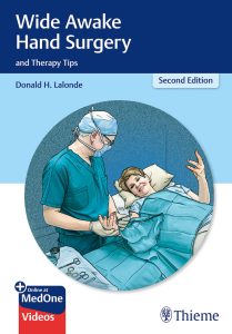 Wide Awake Hand Surgery and Therapy Tips 2nd Edition